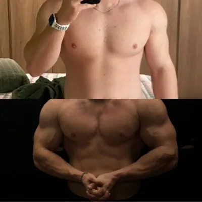 Qualidade de Vida - Giovani - Antes e Depois