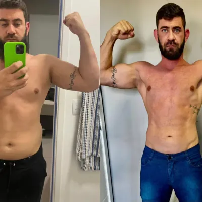 Qualidade de Vida - João - Antes e Depois